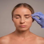 Eyelid Surgery